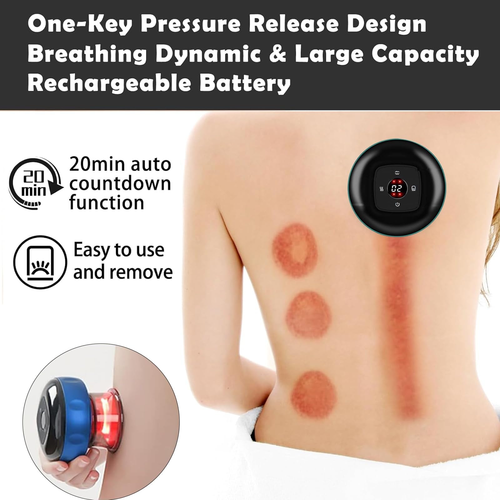Suerbeaty Electric Cupping Therapy Set, Smart Cupping Therapy Massager, Electric Cupping Device with 12 Level Suction and Temperature, Portable Smart Dynamic Cupping Set, Improves Blood Circulation