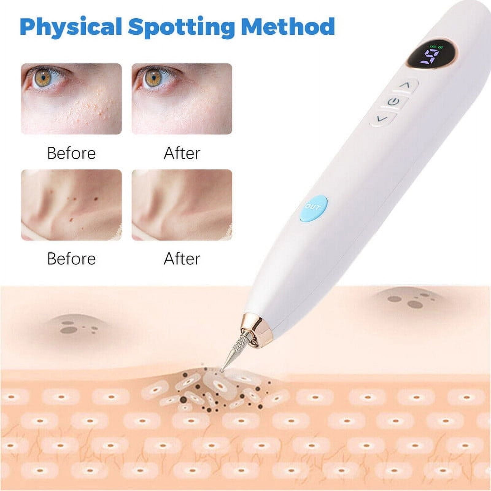 Suerbeaty Portable Tag Removal Skin with 9 Modes Adjustment,USB Charging,Electric Skin Care Removal Set