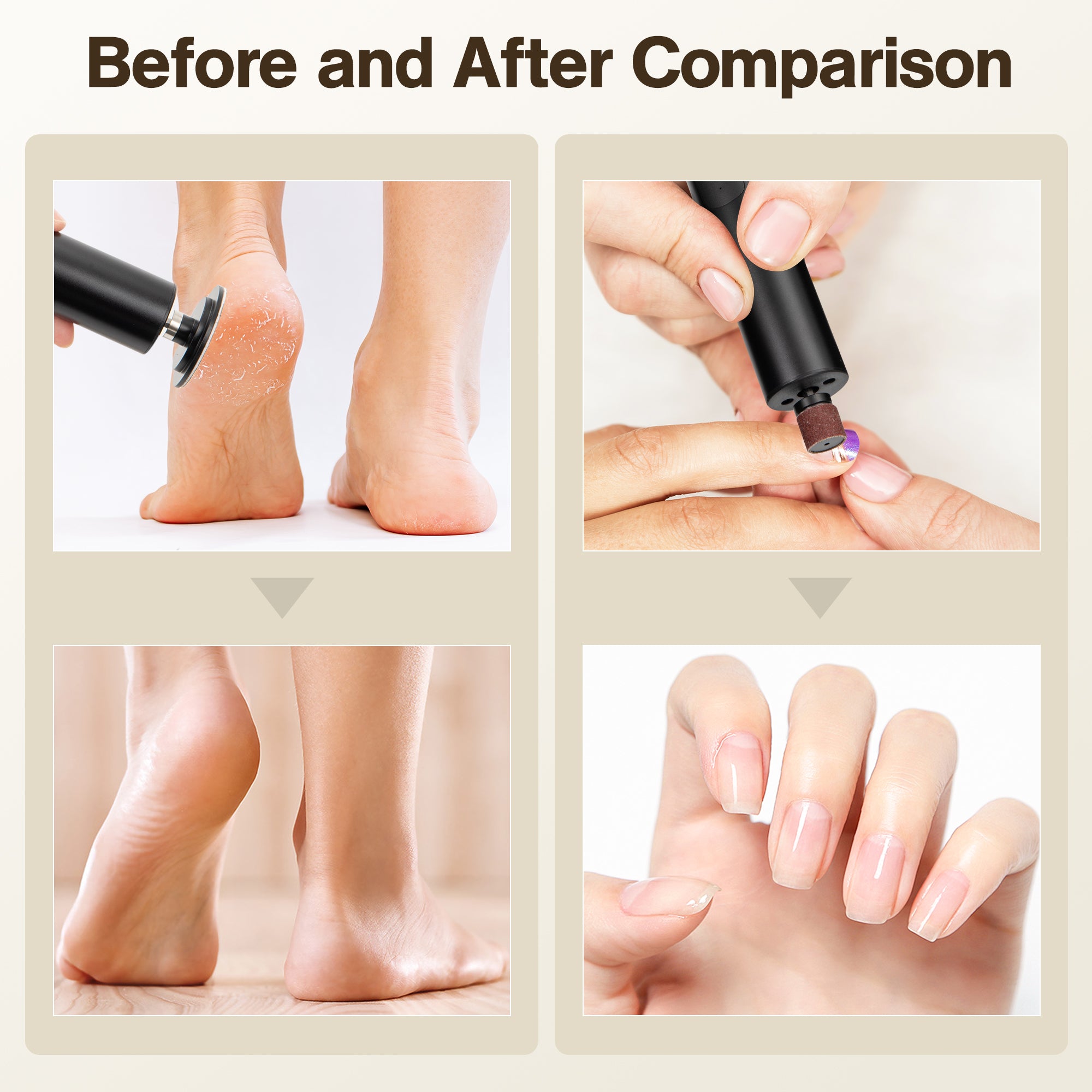 2-in-1 Electric Callus Remover & Nail Grinder