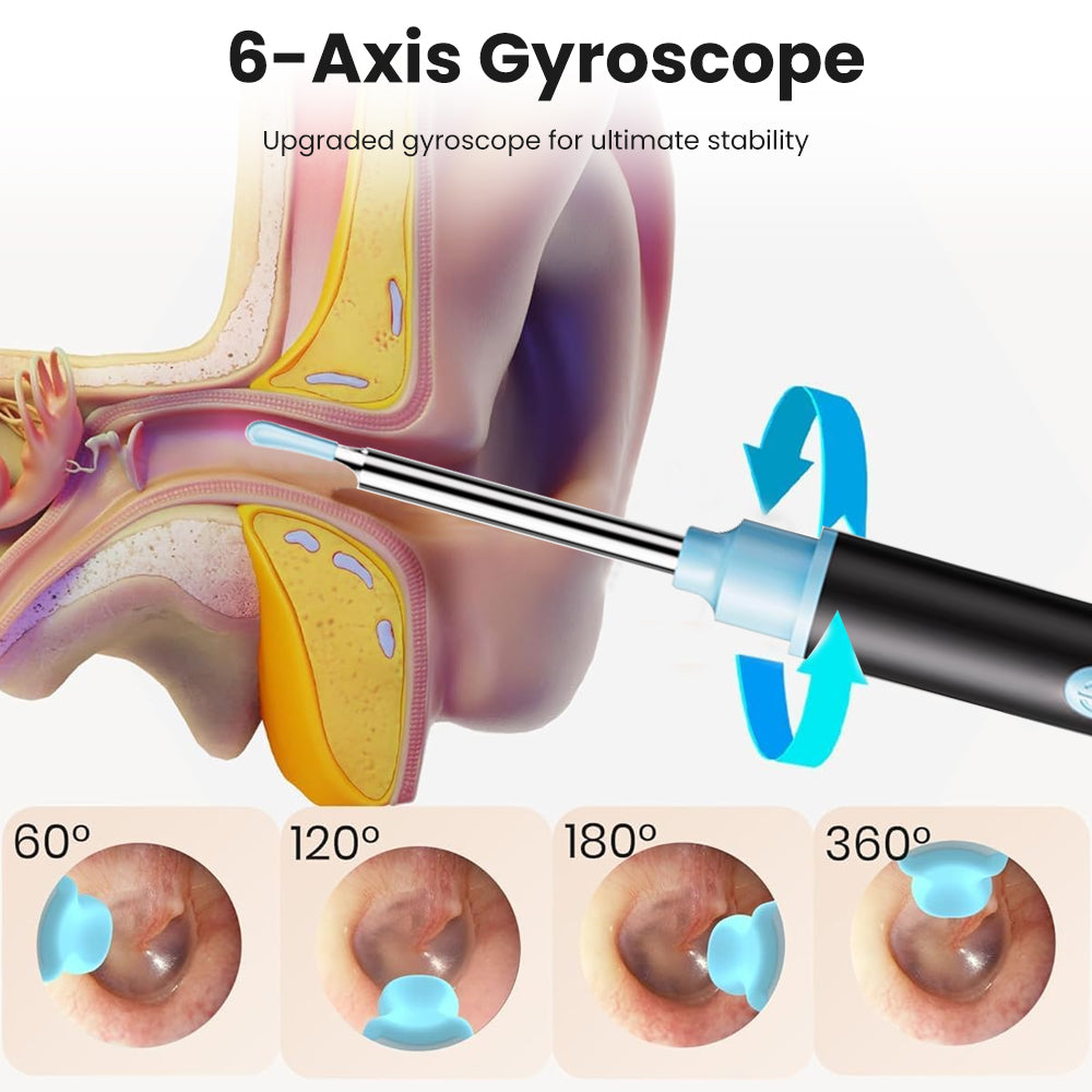 Ear Wax Removal, Ear Cleaner with 1080P Ear Camera, Wireless Earwax Removal Kit with 6 Ear Spoon and LED Light for Ear Cleaning