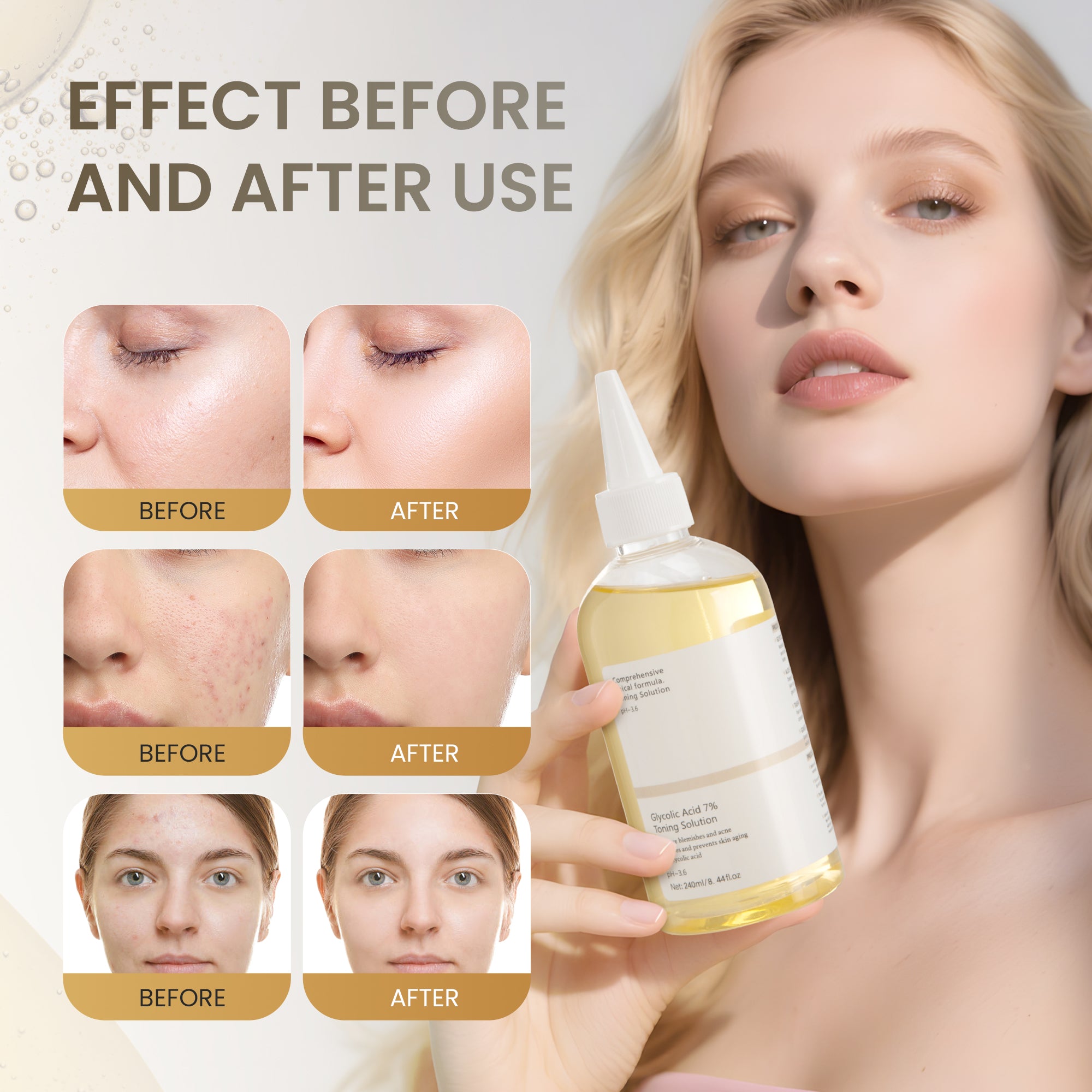 Glycolic Acid 7% Exfoliating Toner - 2 Pack (240ml x 2) – Gently Exfoliates & Hydrates