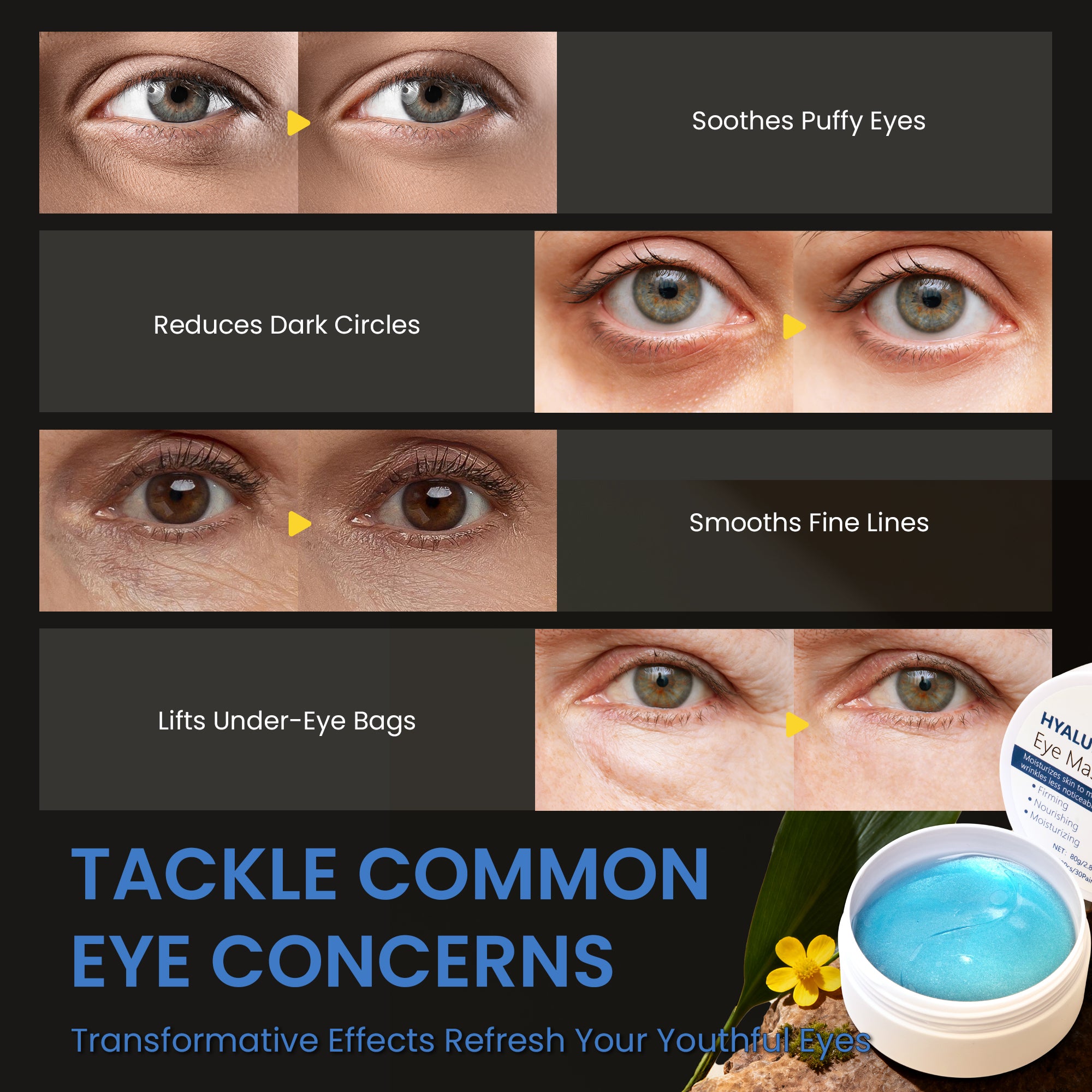 Ouwald Under Eye Patches, Eye Mask for Dark Circles, Puffy Eyes, Eye Bags & Wrinkles, Anti-Aging Hyaluronic Acid Eye Pads, 30 Pairs