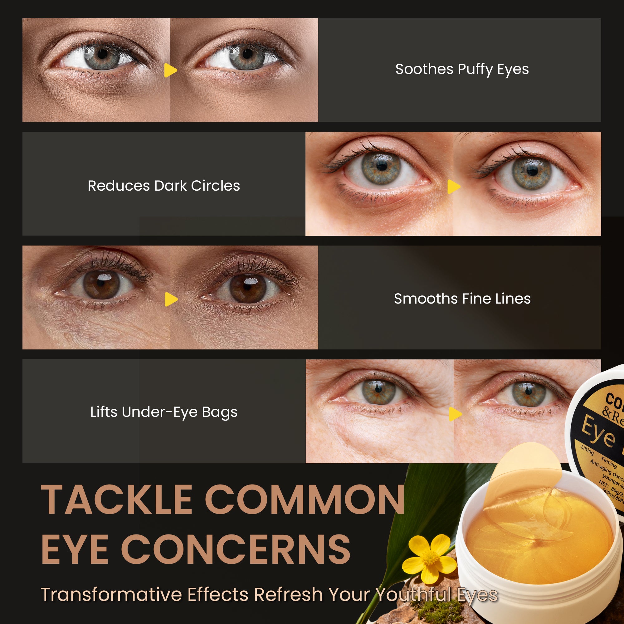 Ouwald Under Eye Patches, Eye Mask for Dark Circles, Puffy Eyes, Eye Bags, Wrinkles, Retinol & Collagen Anti-Aging Eye Pads, 30 Pairs