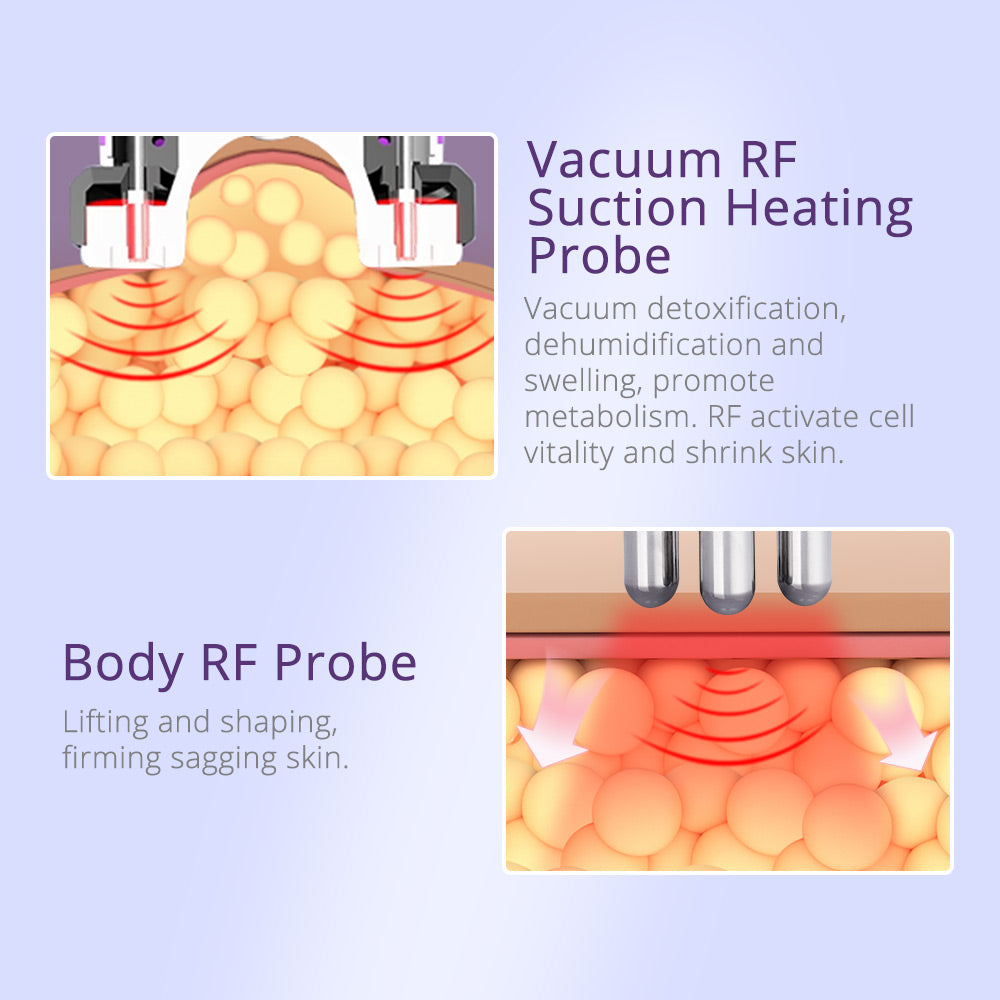 vacuum rf treatment