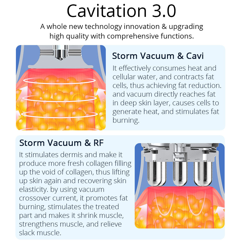 fat cavitation treatments