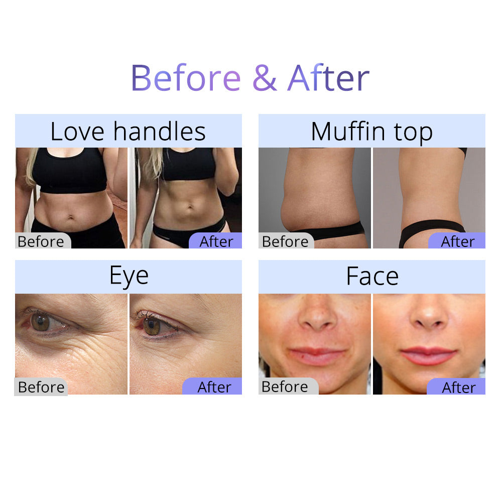 ultra cavitation before and after