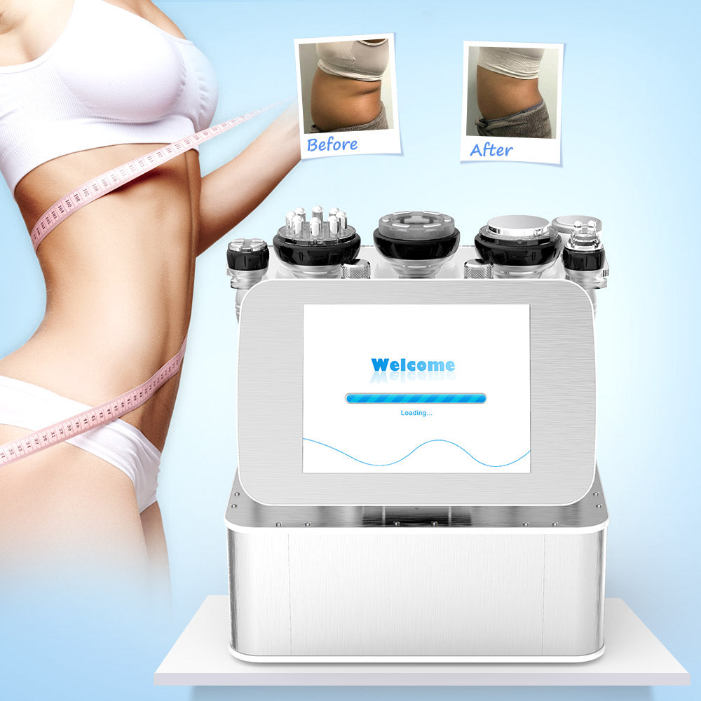 cavitation and radio frequency treatment